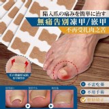 2盒/ 無痛款 嵌甲矯正帖片60貼