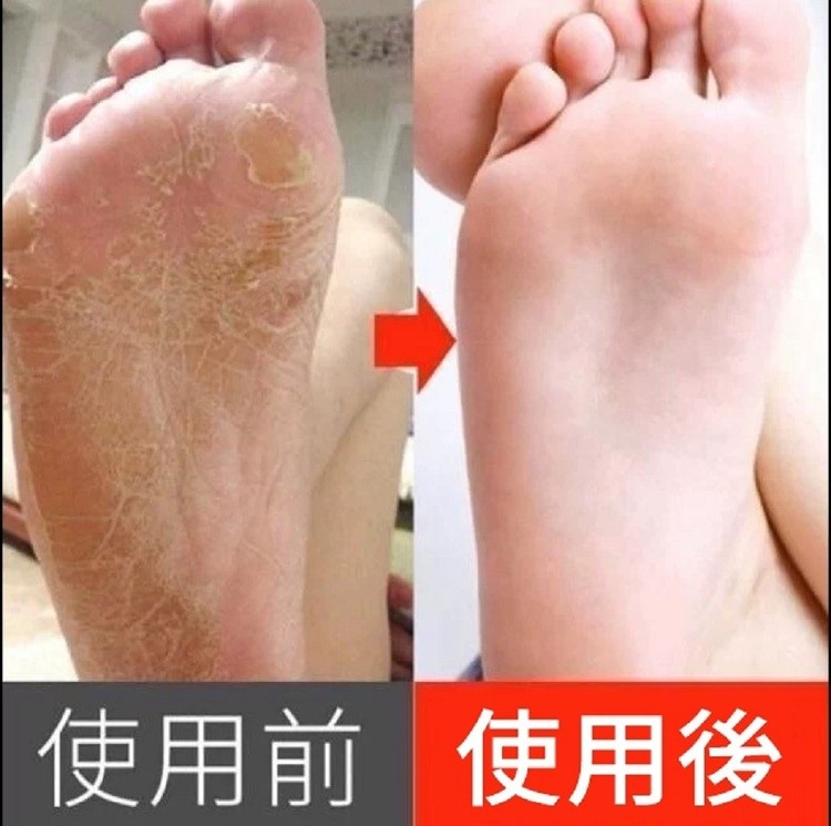 使用前 使用後。