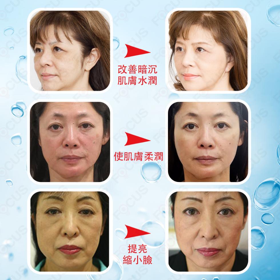 改善暗沉，肌膚水潤，使肌膚柔潤，縮小臉。