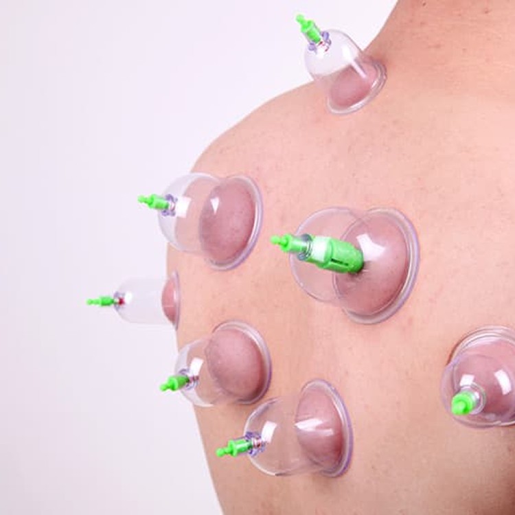 康念抽器真空拔罐12件組