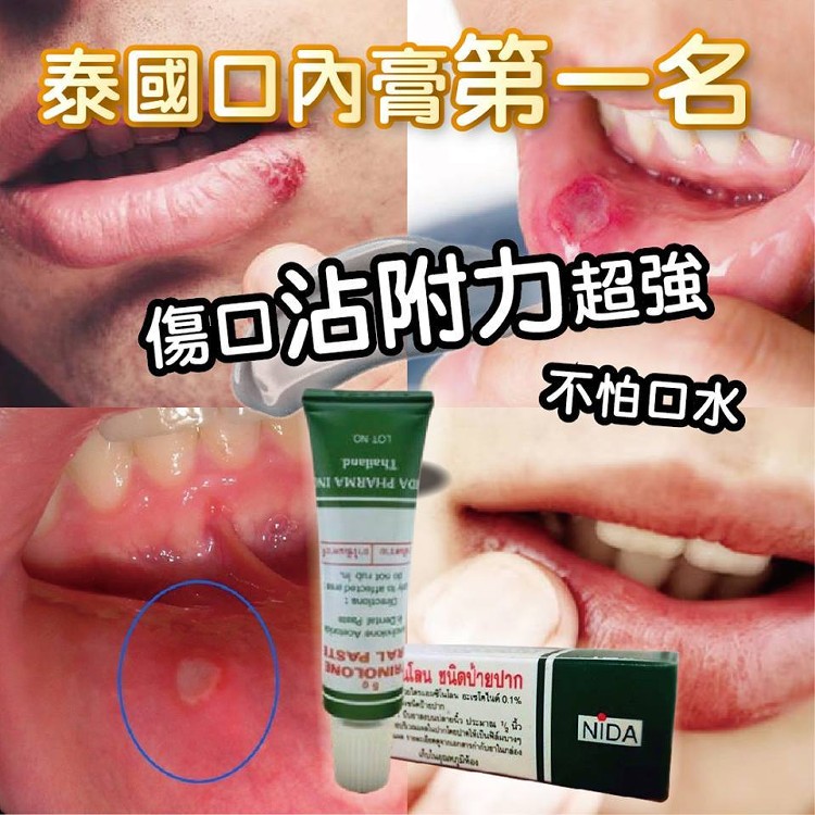 泰國第一好用 NIDA神奇口內膏