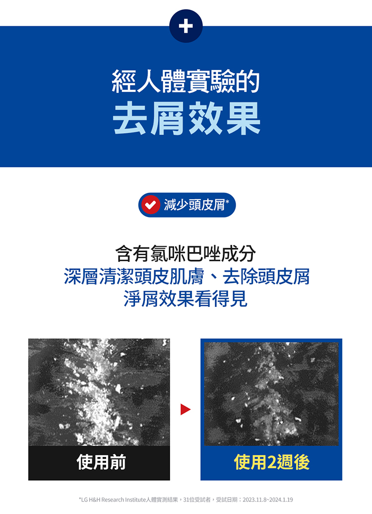 經人體實驗的，去屑效果，減少頭皮屑，含有氯咪巴唑成分，深層清潔頭皮肌膚、去除頭皮屑，淨效果看得見，使用前，使用2週後，LG H&H Research Institute人體實測結果,31位受試者,受試日期:2023.11.8~2024.1.19。