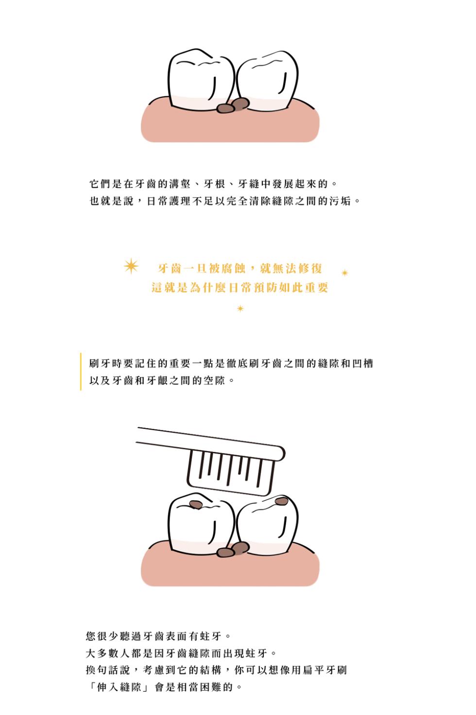 它們是在牙齒的溝壑、牙根、牙縫中發展起來的。也就是說,日常護理不足以完全清除缝隙之間的污垢。牙齒一旦被腐蝕,就無法修復，這就是為什麼日常預防如此重要，刷牙時要記住的重要一點是徹底刷牙齒之間的縫隙和凹槽，以及牙齒和牙齦之間的空隙。您很少聽過牙齒表面有蛀