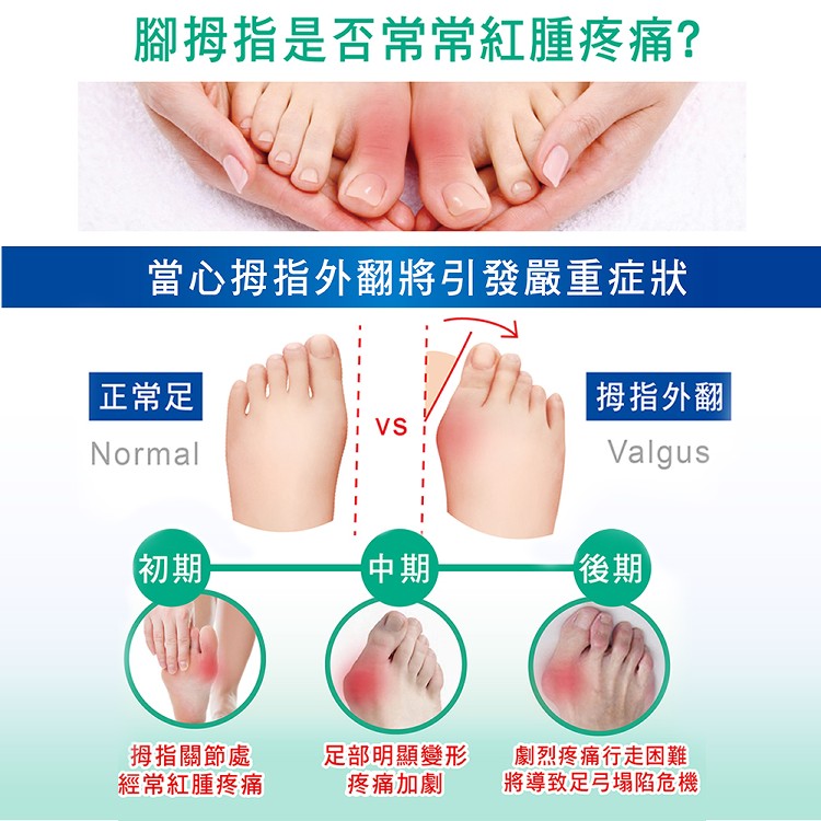 最新代黑科技【拇指外翻神器】獨家添加銀離子竹炭粉