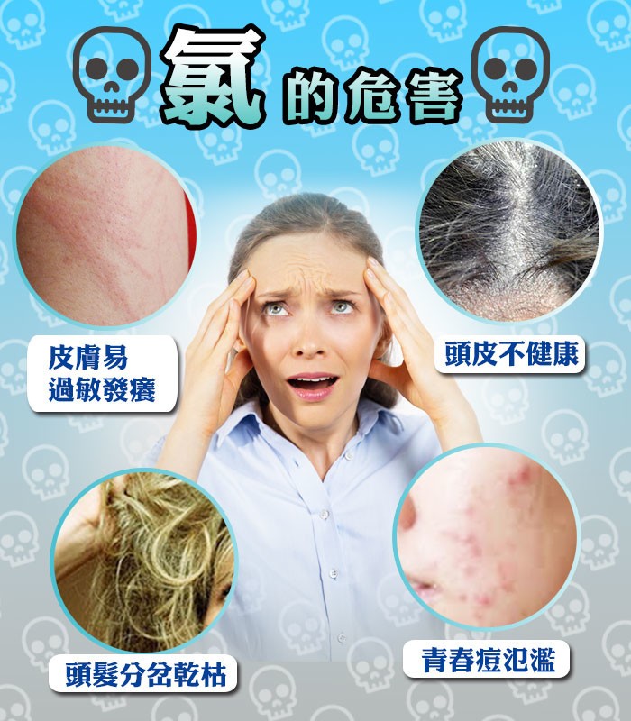 の氯的危害，頭皮不健康，皮膚易，過敏發癢，頭髮分岔乾枯，青春痘氾濫。