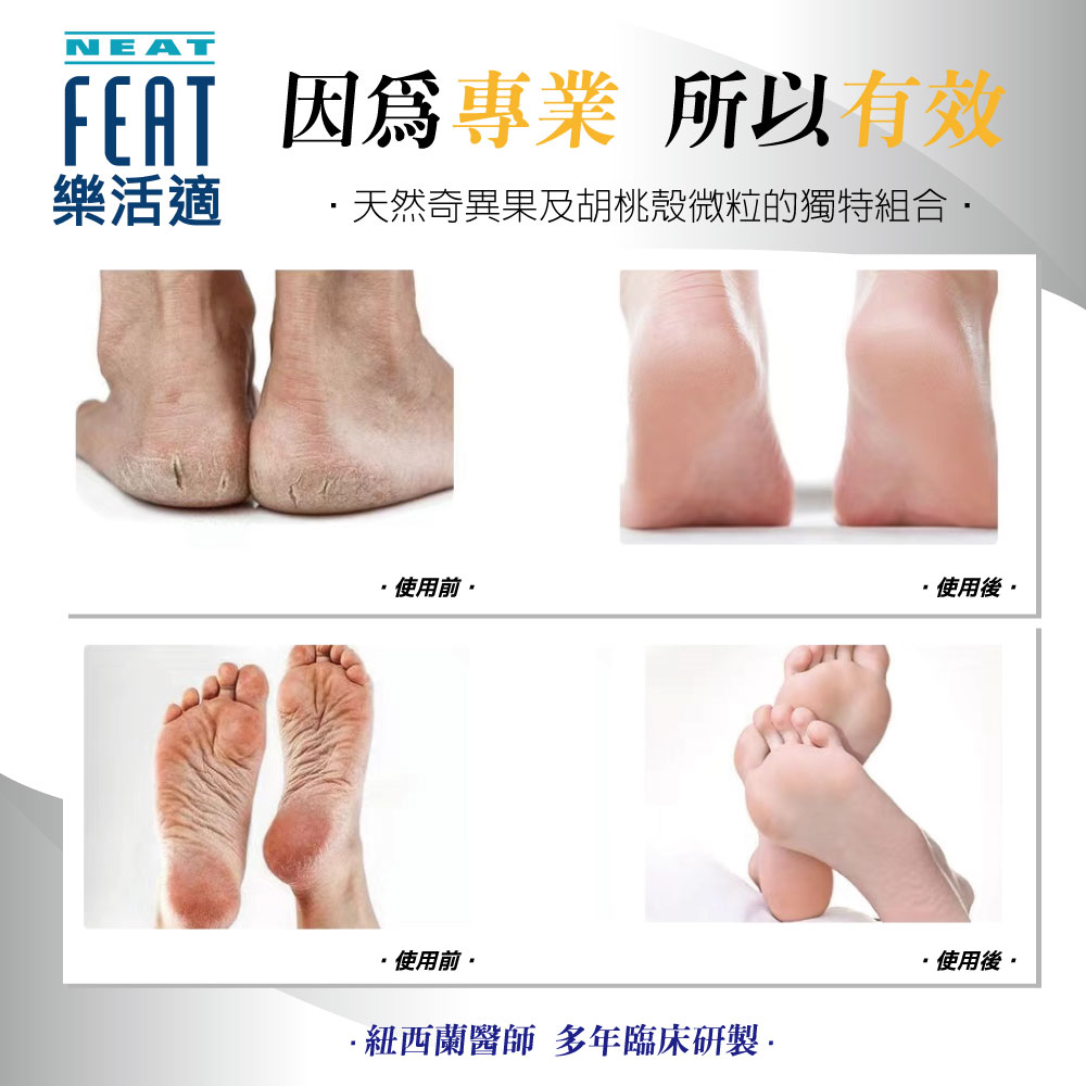 FEAT 因為專業 所以有效，樂活適，·天然奇異果及胡桃殼微粒的獨特組合・，·使用前·，・使用後・，·使用前•，·紐西蘭醫師 多年臨床研製·，・使用後。